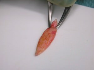 Das Hauttransplantat liegt mit der Unterseite nach oben. Man kann das gelbe Unterhautfettgewebe erkennen.