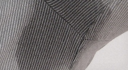 Starkes Schwitzen unter den Achseln Starkes Schwitzen unter den Achseln