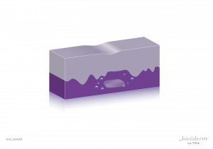 Falte nach der Auffüllung Falte nach der Auffüllung