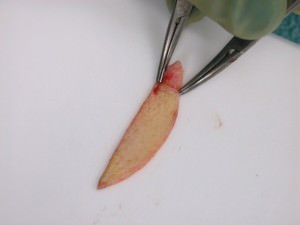 Die Unterseite des Transplantats ist vom Fettgewebe befreit. Es kann jetzt sicher anwachsen. Die Unterseite des Transplantats ist vom Fettgewebe befreit. Es kann jetzt sicher anwachsen.