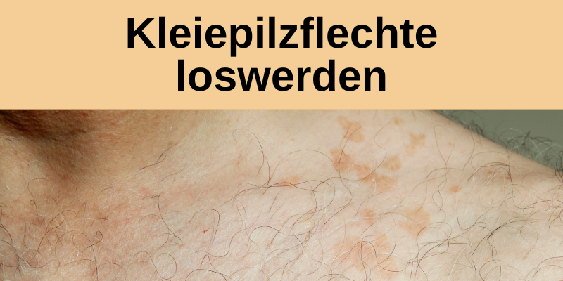 Schwitzpilz loswerden
