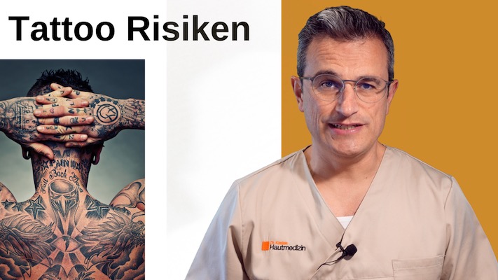Tattoo Risiken
