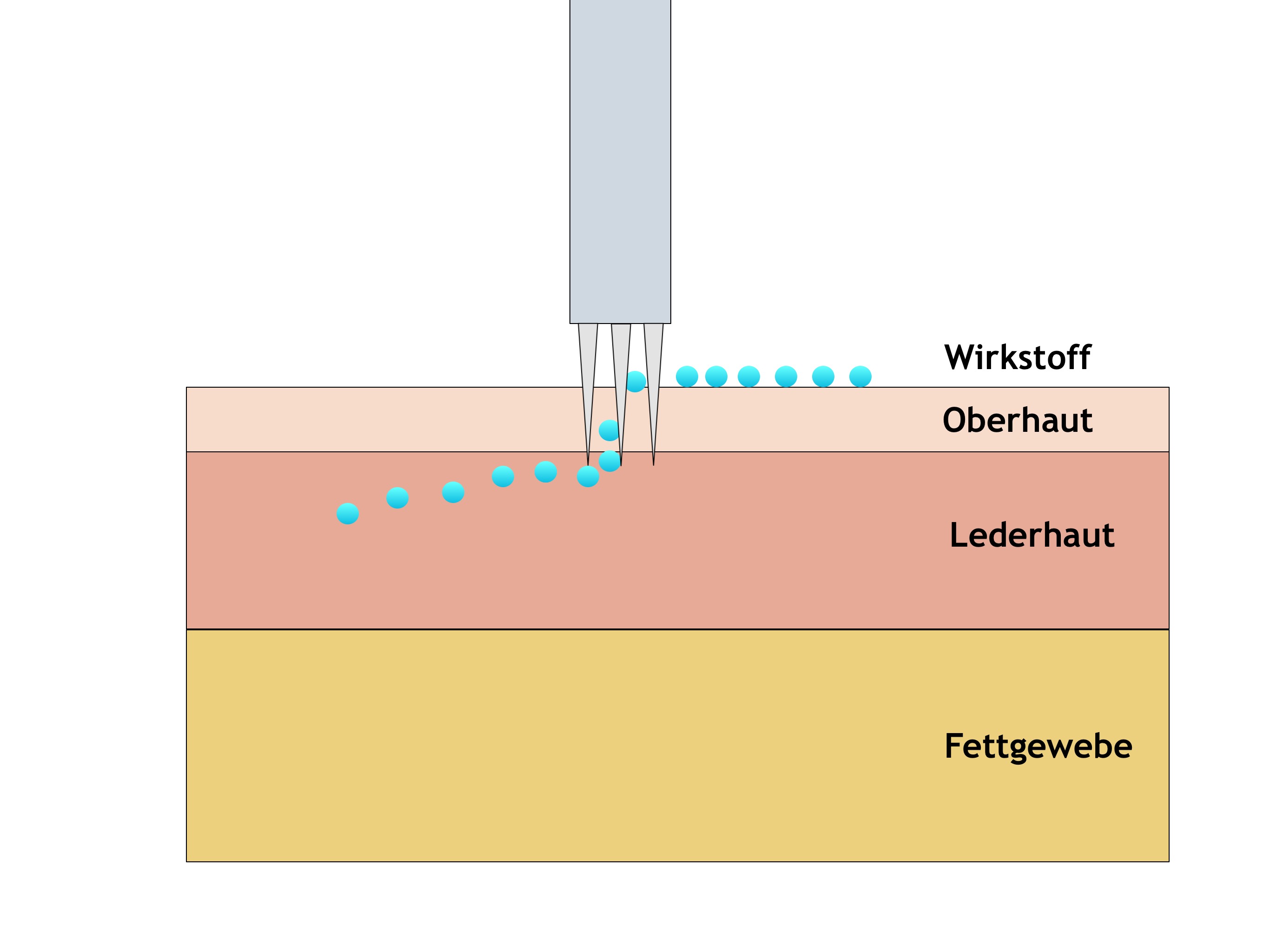 Mikroneedling