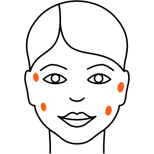 Altersflecken Behandlung (Heilende Medizin) Altersflecken Behandlung (Heilende Medizin)