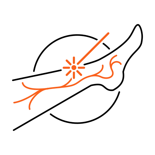 Besenreiser Laser Besenreiser Laser