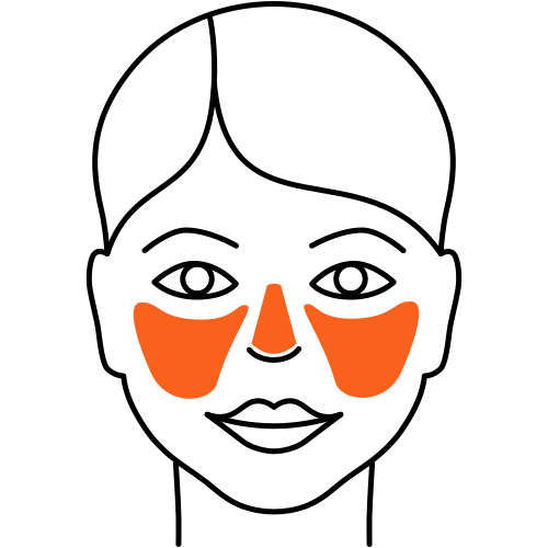 Rosazea (Heilende Medizin) Rosazea (Heilende Medizin)