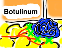 Schweißdrüse Botulinum Detail