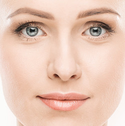 Facelift ohne OP