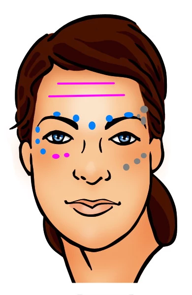 Frische, strahlende Augen mit einer ganzheitlichen medizinisch- kosmetischen Behandlung