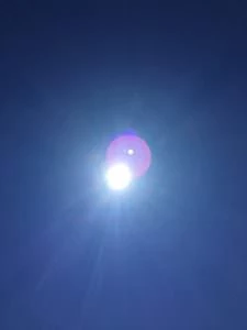 Was tun bei einem Sonnenbrand?