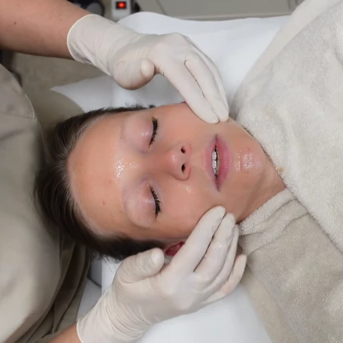 Fruchtsäure Peeling Mainz Fruchtsäure Peeling Mainz