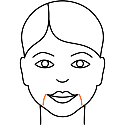 Marionettenfalten Marionettenfalten