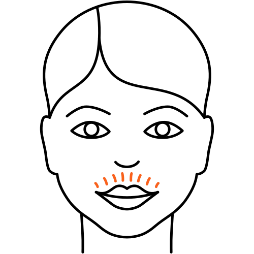 Oberlippenfalten behandeln Oberlippenfalten behandeln