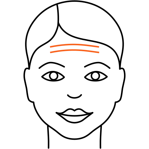 Stirnfalten Stirnfalten