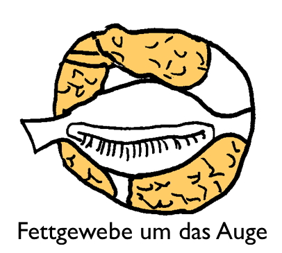 Überschüssiges Fettgewebe Auge