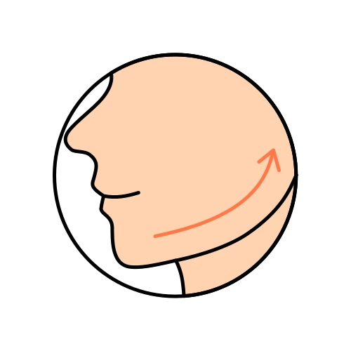 Fadenlifting