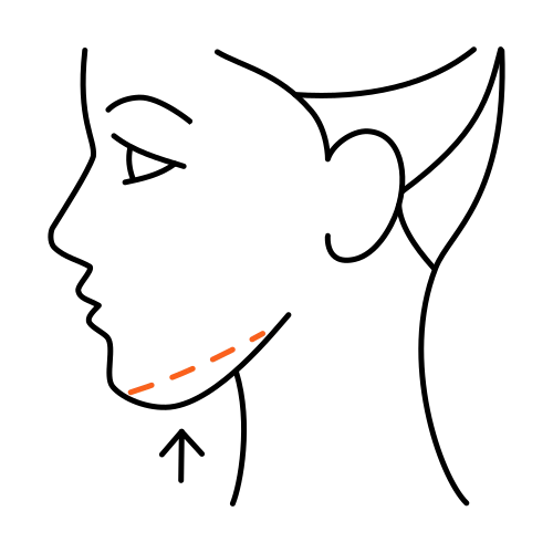 Lipolyse