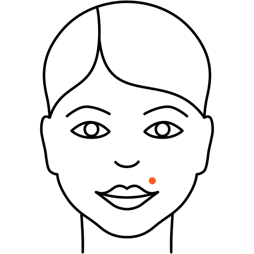 Muttermal (Heilende Medizin)