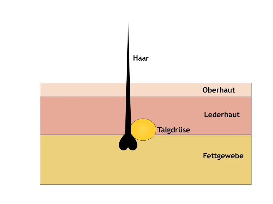 Entfernen talgdrüsen vorhaut Talgdrüsen an