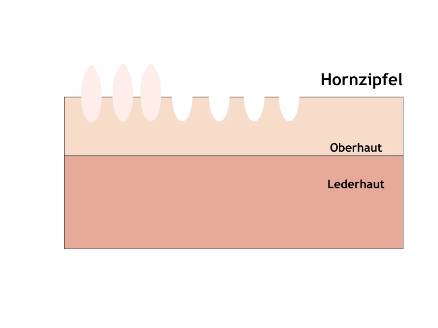 Bilder hornzipfel Hornzipfel, Hornzipfelchen