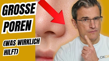  Große Poren: Was wirklich hilft und was nicht | Dr. med. Robert Kasten