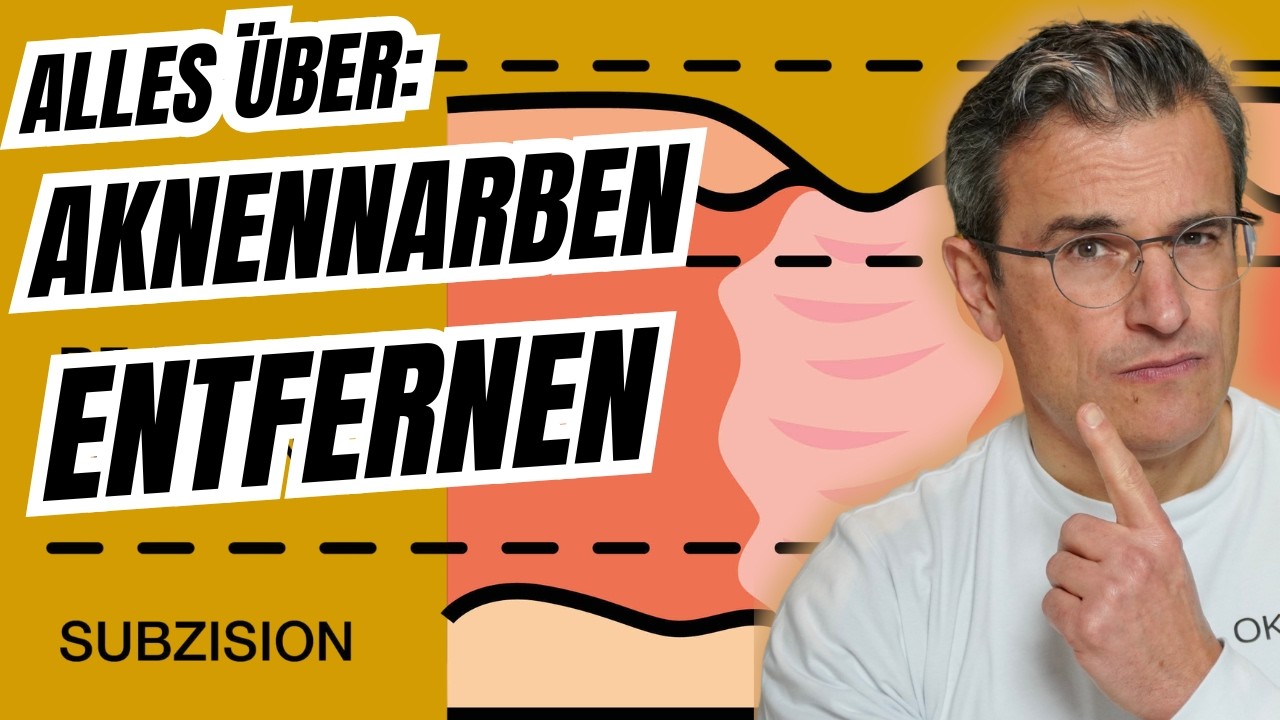 Aknenarben entfernen in Mainz