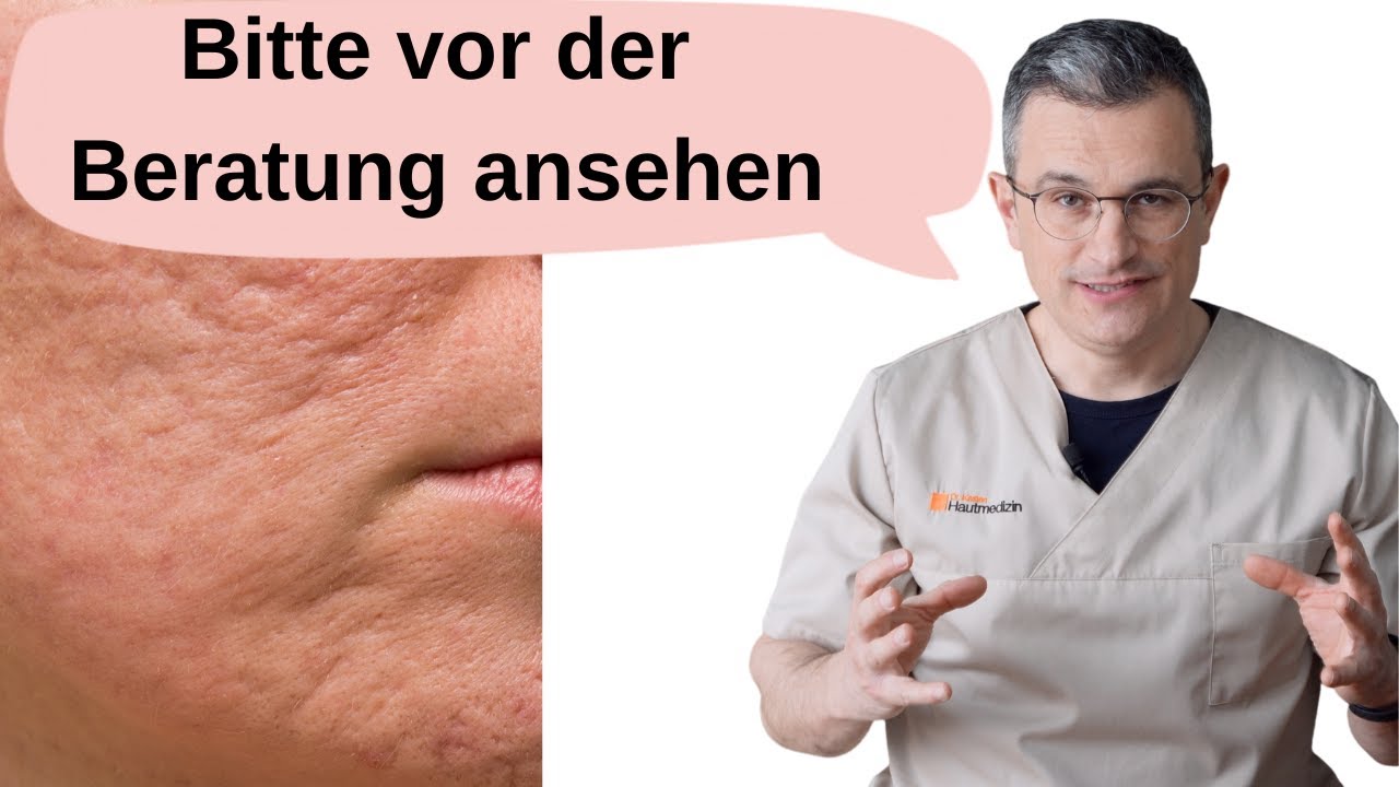 So können Aknenarben behandelt werden